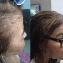 Kit Progressiva + Ativador de Crescimento PRO+ Lisana